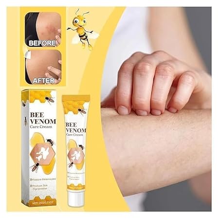 VitiGO Bee Venom Treatment Cream - Image 5