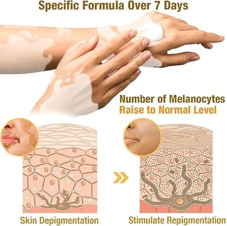 VitiGO Bee Venom Treatment Cream - Image 2