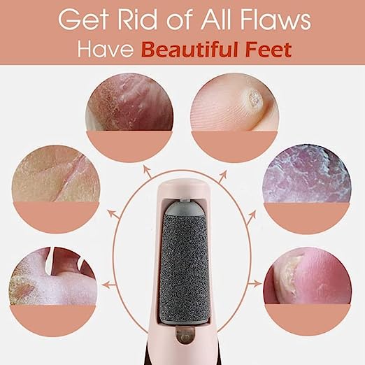 Electric Pedicure Foot Callus Grinder USB Charging Feet Care Dead Skin Remover Machine Foot File Callus Remover Cordless Foot File Easy Grip Adjustable - Image 2