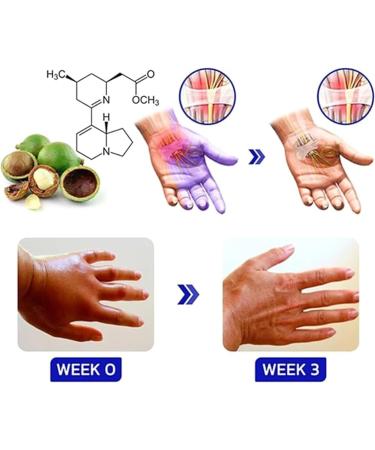 Numbfix Hand and Foot spray - Image 3