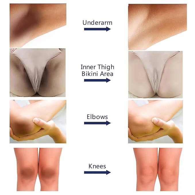 Whitening Cream For Dark Skin Area - Image 8