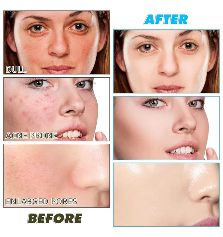 Turmeric Kojic Acid Exfoliating Cleansing Pads - Image 3