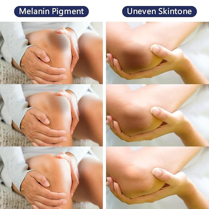 Whitening Cream For Dark Skin Area - Image 7