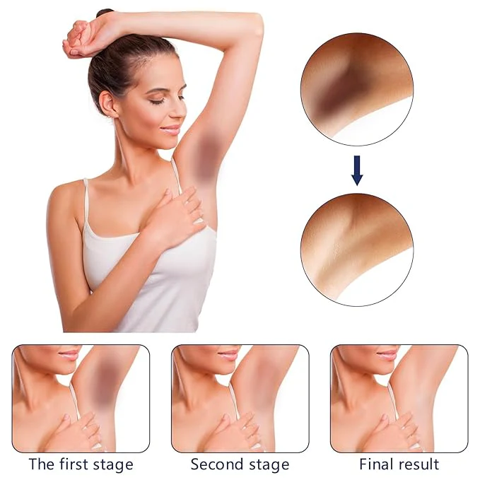 Whitening Cream For Dark Skin Area - Image 5