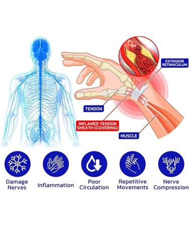 Numbfix Hand and Foot spray - Image 4