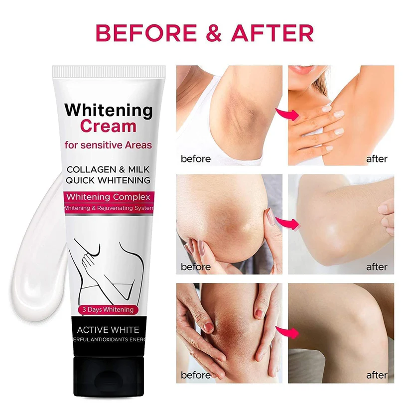 Whitening Cream For Dark Skin Area - Image 10